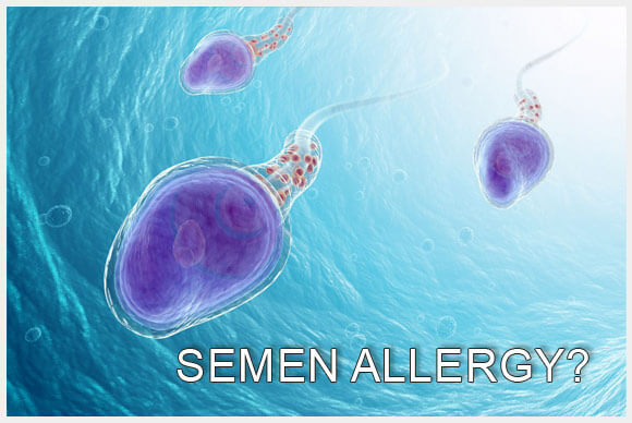 Semen Allergy