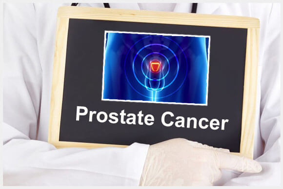 Prostate Cancer Patterns| Development and Progression | Dr. Elist Health Blog