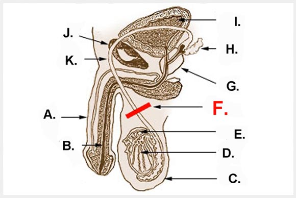 Vasectomy Benefits and Risks