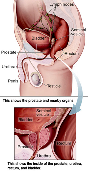 Prostatectomy: Prostate Anatomy