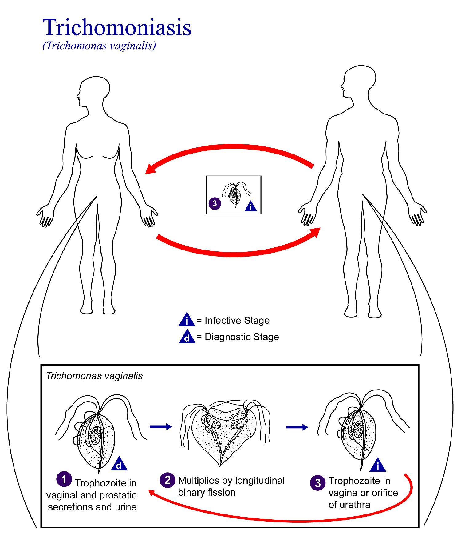 Trichomoniasis Symptoms