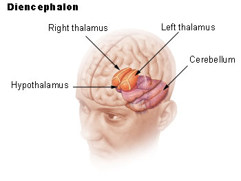sex and stroke