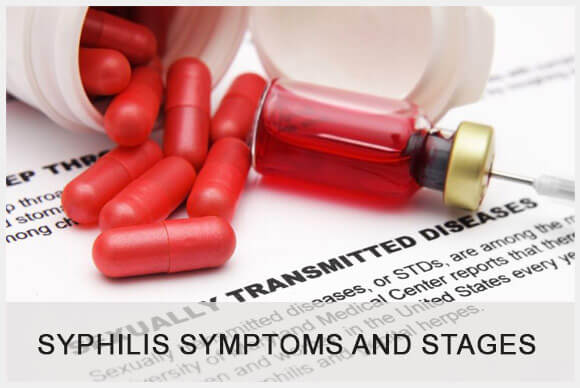 STD: Syphilis Symptoms and Stages