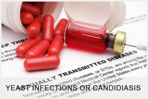 Yeast Infections or Candidiasis