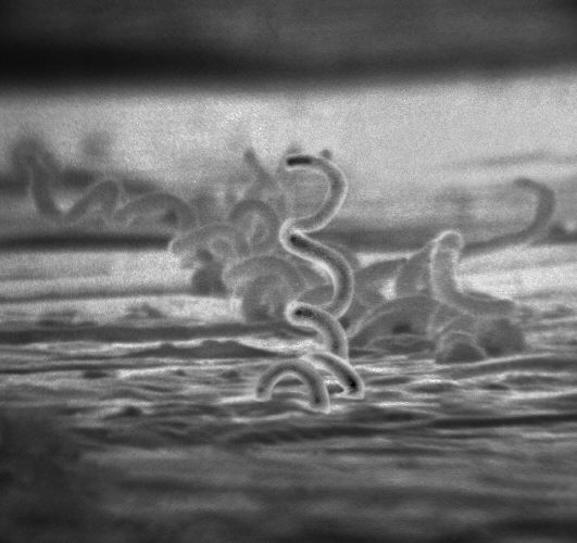 Syphilis treatment and prevention