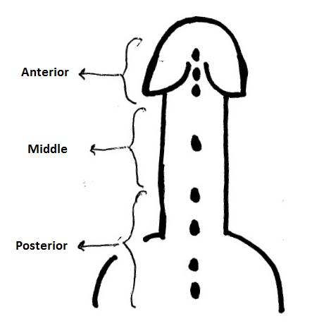Hypospadias, Penis Image