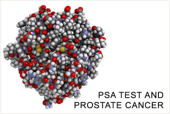 PSA Test and Prostate Cancer