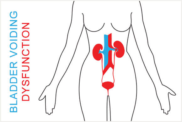 Bladder Voiding Dysfunction | Pathophysiology of Voiding Dysfunction