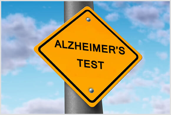 Alzheimer | Alzheimer's Test