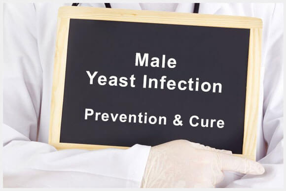 Male Yeast Infection: Prevention & Cure