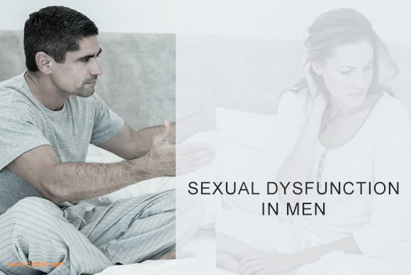 Sexual Dysfunction and Disorder in Men
