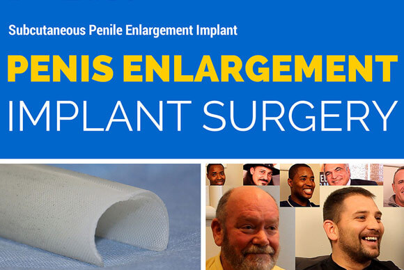 Penis Enlargement Surgery Animation Video
