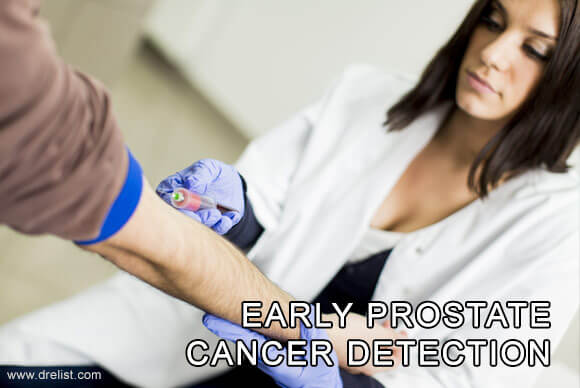 Early Prostate Cancer Detection
