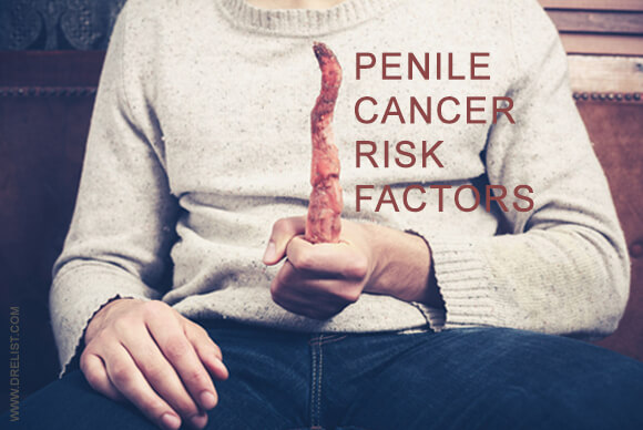 Penile Cancer Risk Factors