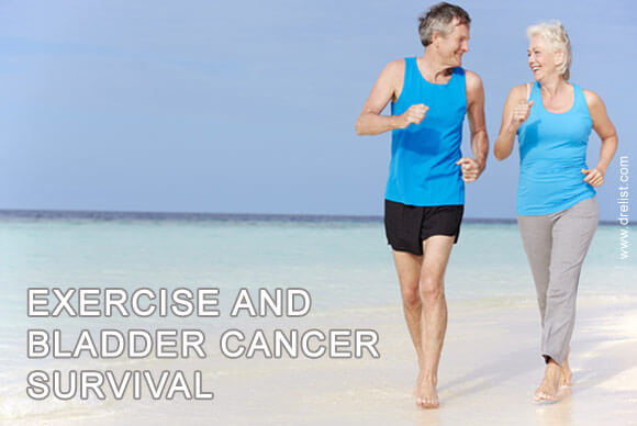 Exercise and Bladder Cancer Survival