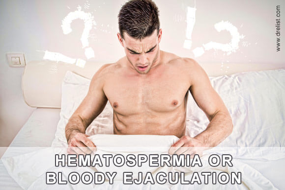 Hematospermia Definition, Causes and Treatments