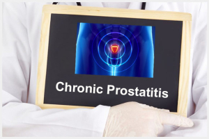 Chronic NonBacterial Prostatitis and Diet