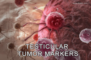 Testicular Tumor Markers Image