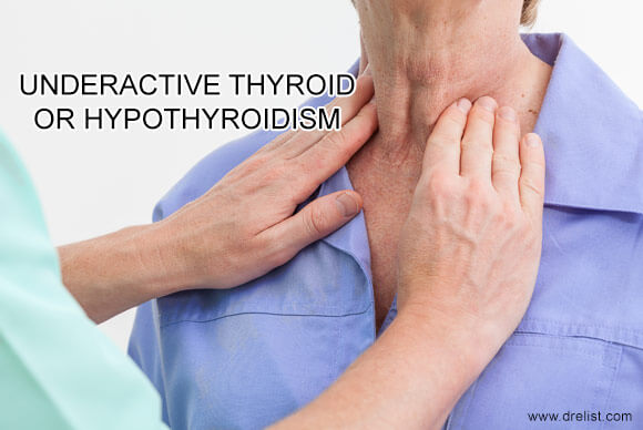 Underactive Thyroid | Hypothyroidism