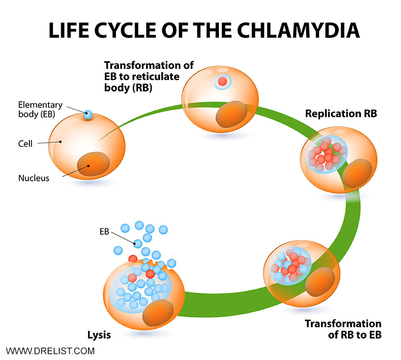 Chlamydia Infections Image