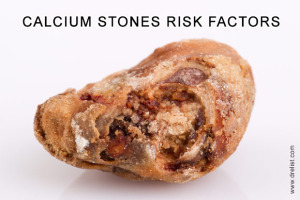 Risk Factors for Calcium Stones Image