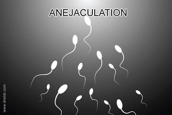 What is Anejaculation?