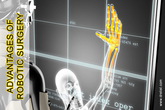 Advantages of Robotic Surgery