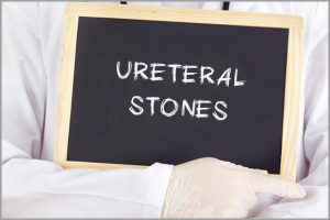 Ureteral Stones Info.