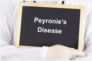 blog-peyronies