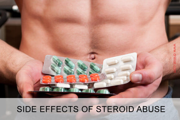 Side Effects of Steroid Abuse