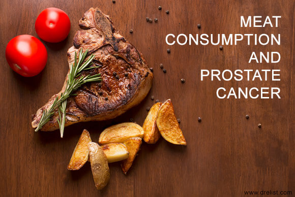 Meat Consumption and Prostate Cancer