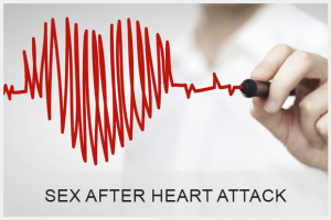 Sex After Heart Attack