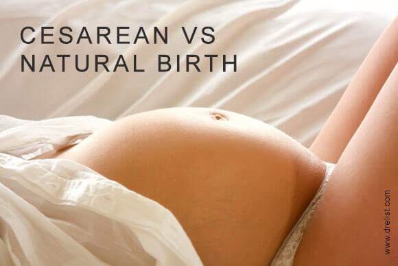 Cesarean Versus Natural Birth