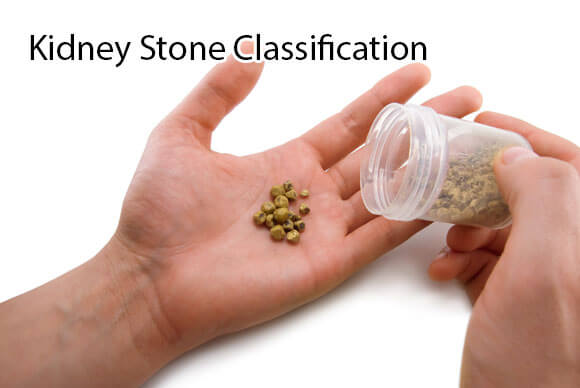 Kidney Stone Classification