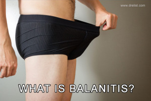 What is Balanitis Image