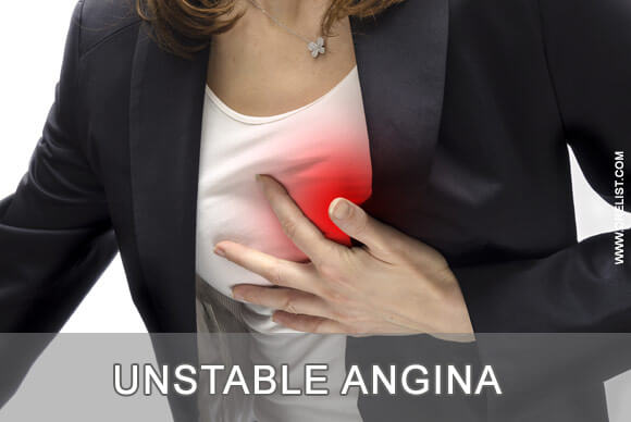 Unstable Angina