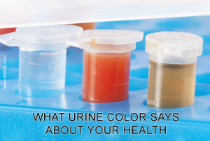 Urine color image