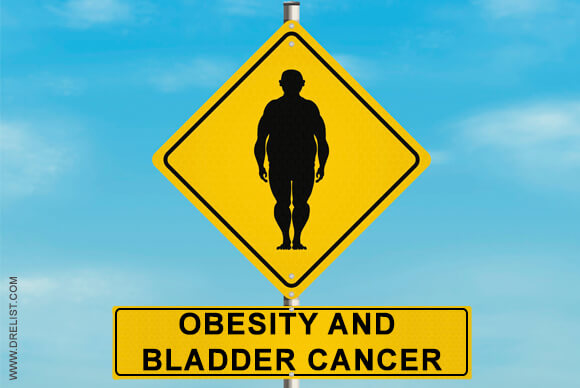 Obesity and Bladder Cancer