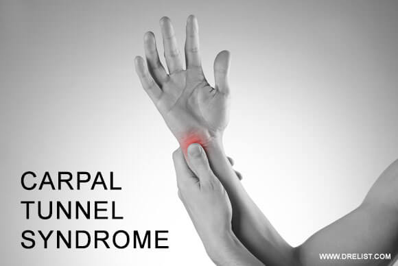 Carpal Tunnel Syndrome