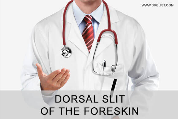 Dorsal Slit of the Foreskin