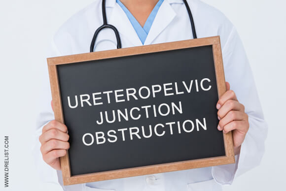 Ureteropelvic Junction Obstruction