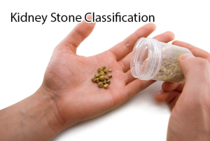 Kidney Stone Image