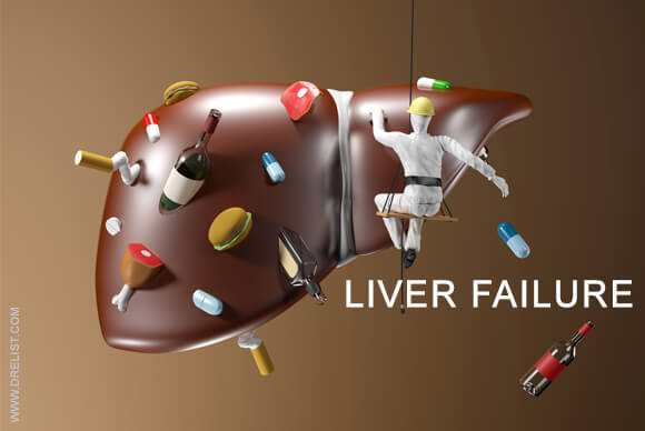 Liver Failure