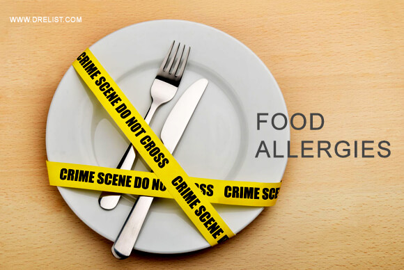 Food Allergies