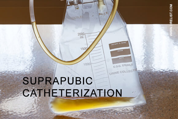 Suprapubic Catheterization