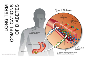 Long Term Complications of Diabetes