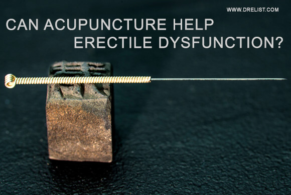 Will Acupuncture Help Erectile Dysfunction?