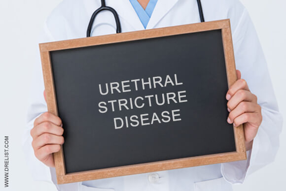 Urethral stricture disease