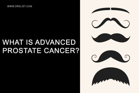 What is Advanced Prostate Cancer?