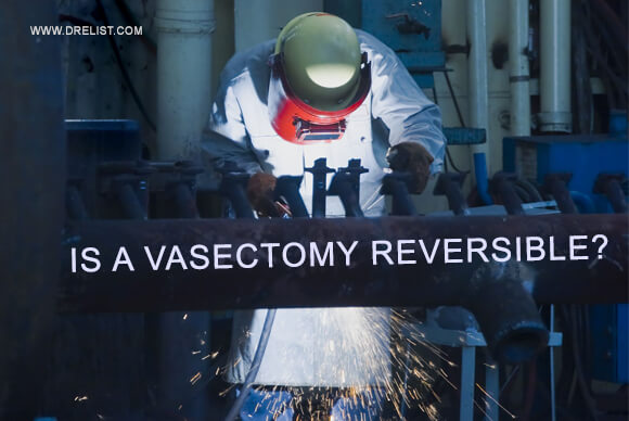 Is a Vasectomy removable?